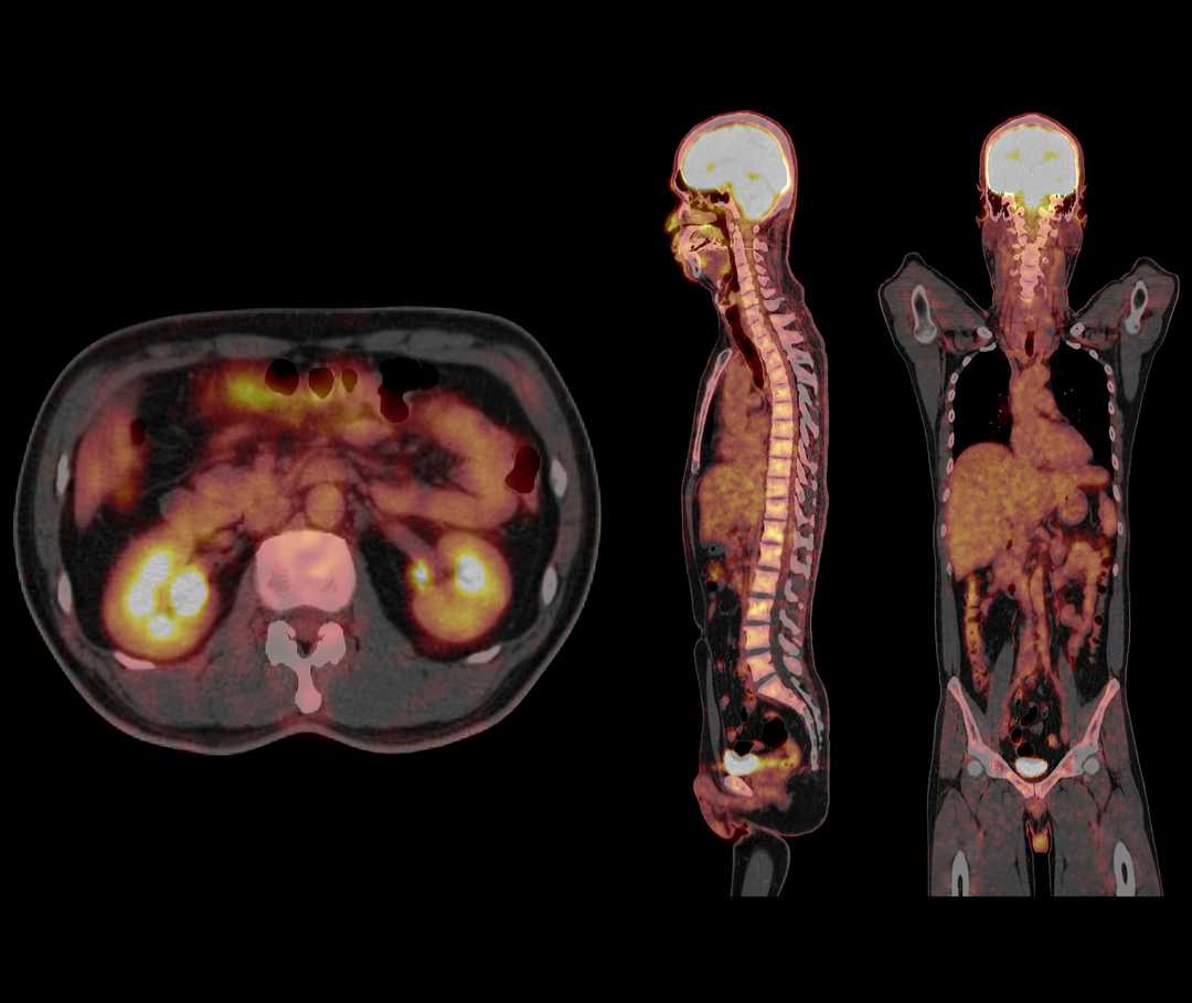 CT Scan eines Patienten